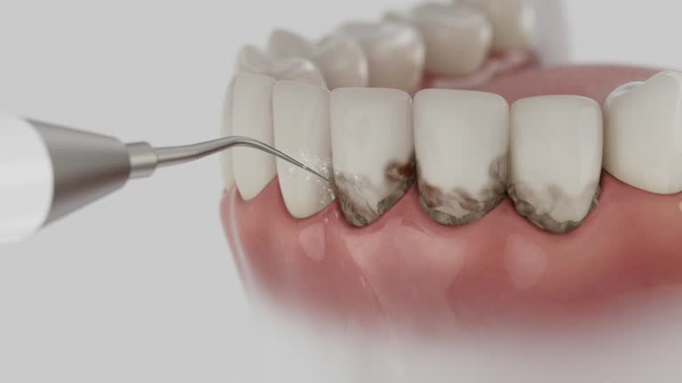 Reliable Root Canal Treatment contractor in Clay County County, AR by Dentist Open Now